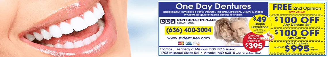 dentures hillsboro mo